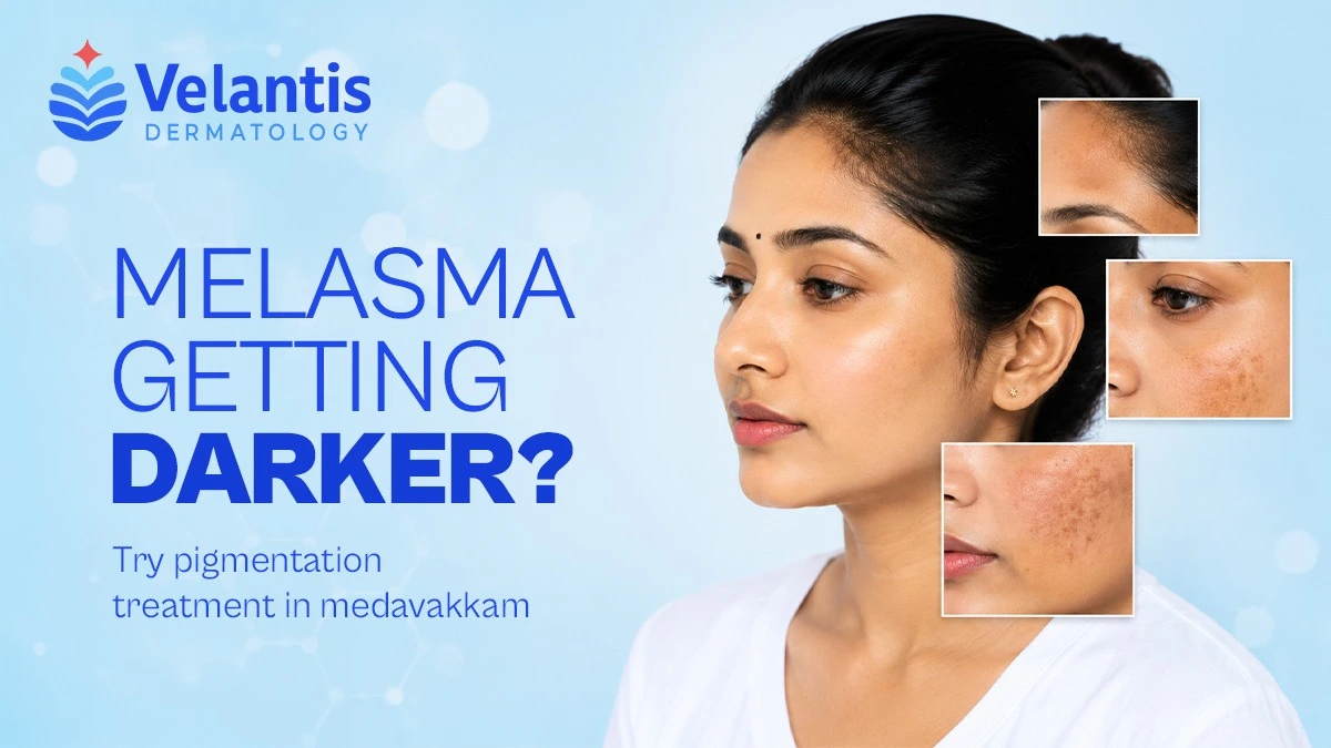 Is Melasma Getting Worse Over Time? What Happens If You Delay Treatment?