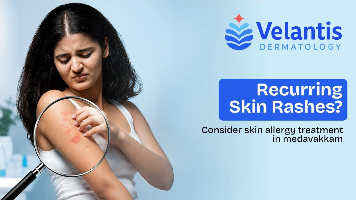 Are Recurring Skin Rashes a Sign You Need Dermatologist Evaluation?