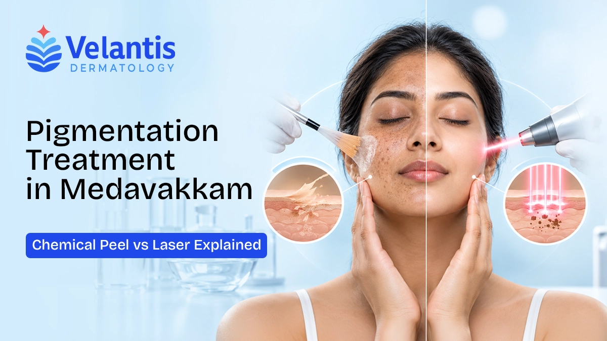 Chemical Peel vs Laser for Pigmentation Which Treatment May Suit You