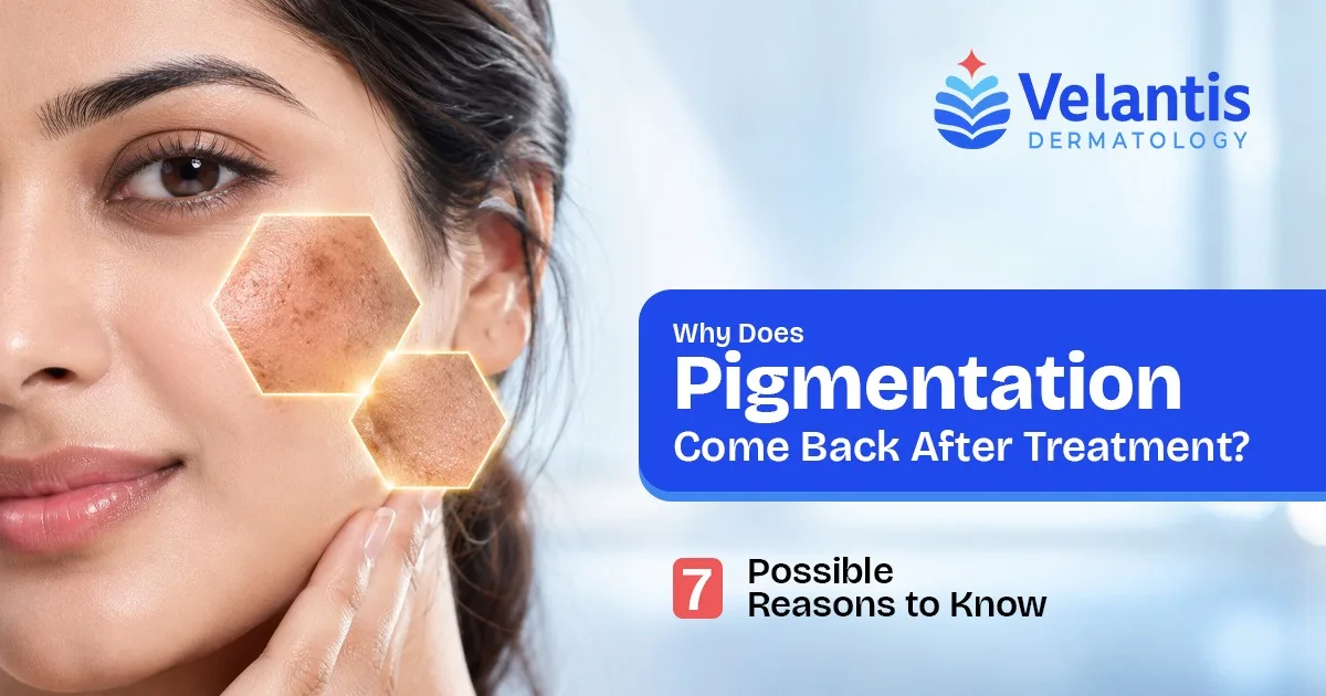 Why Does Pigmentation Come Back After Treatment? 7 Possible Reasons