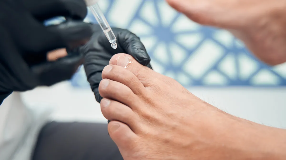 Fungal Nail Infection Treatment: Causes, Symptoms, and Solutions